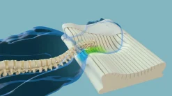 Clearance CENTA-STAR Nackenstützkissen NECKPROTECT